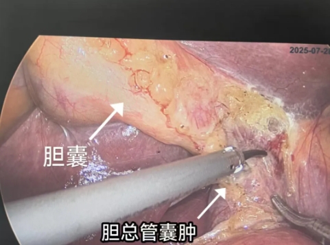 微信截图_20250915125827.png